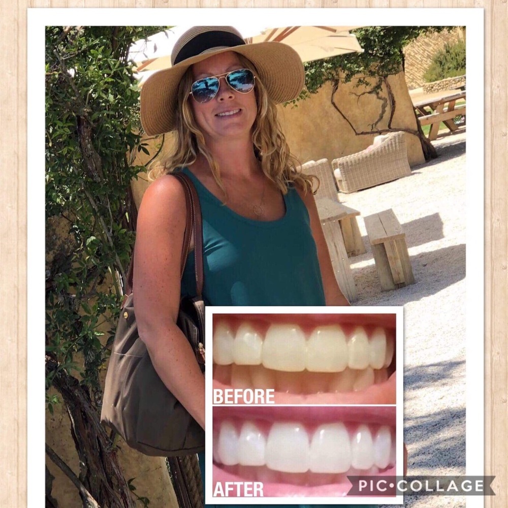 Daily Whitening Toothpaste